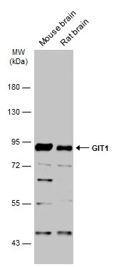 GIT1 antibody [N3C2], Internal