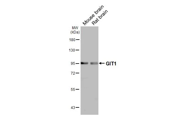 Various tissue extracts (50 μg) were separated by 7.5% SDS-PAGE, and the membrane was blotted with GIT1 antibody [N3C2], Internal (GTX105824) diluted at 1:1000. The HRP-conjugated anti-rabbit IgG antibody (GTX213110-01) was used to detect the primary antibody.