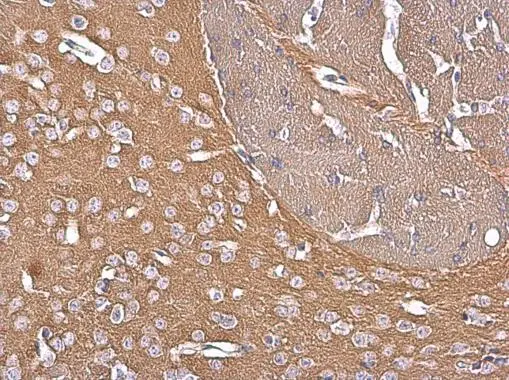 GNAZ antibody [N2C3] detects GNAZ protein at cytoplasm by immunohistochemical analysis. Sample: Paraffin-embedded mouse brain. GNAZ stained by GNAZ antibody [N2C3] (GTX105832) diluted at 1:500.