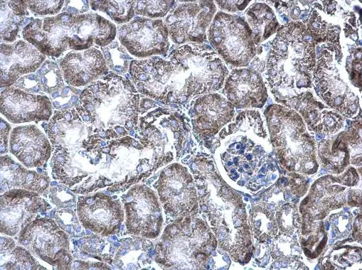 WBSCR22 antibody