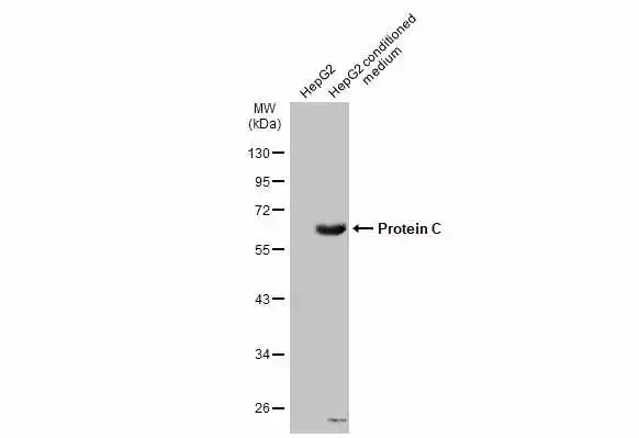 HepG2 whole cell extract and conditioned medium (30 μg) were separated by 10% SDS-PAGE, and the membrane was blotted with Protein C antibody (GTX105844) diluted at 1:1000. The HRP-conjugated anti-rabbit IgG antibody (GTX213110-01) was used to detect the primary antibody. HepG2 whole cell extract and conditioned medium (30 μg) were separated by 10% SDS-PAGE, and the membrane was blotted with Protein C antibody (GTX105844) diluted at 1:1000. The HRP-conjugated anti-rabbit IgG antibody (GTX213110-01) was used to detect the primary antibody.