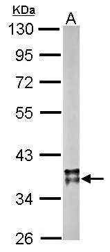 Sample (20 μg of whole cell lysate) A: mouse brain 10% SDS PAGE GTX105870 diluted at 1:10000 The HRP-conjugated anti-rabbit IgG antibody (GTX213110-01) was used to detect the primary antibody.