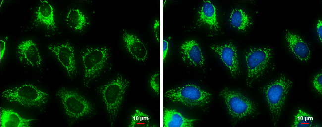 MDH2 antibody detects MDH2 protein at mitochondria by immunofluorescent analysis. Sample: HeLa cells were fixed in ice-cold MeOH for 5 min. Green: MDH2 stained by MDH2 antibody (GTX105870) diluted at 1:500. Blue: Hoechst 33342 staining. Scale bar= 10μm.