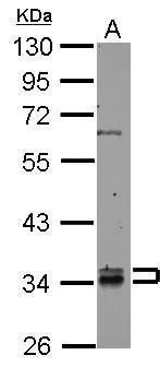 Sample (50 μg of whole cell lysate) A: mouse brain 10% SDS PAGE GTX105874 diluted at 1:1000 The HRP-conjugated anti-rabbit IgG antibody (GTX213110-01) was used to detect the primary antibody.