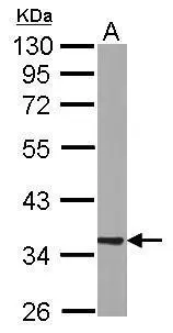 Sample (50 μg of whole cell lysate) A: Rat brain 10% SDS PAGE GTX105874 diluted at 1:1000 The HRP-conjugated anti-rabbit IgG antibody (GTX213110-01) was used to detect the primary antibody.