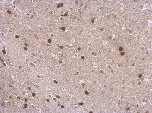 NPAS1 antibody detects NPAS1 protein at nucleus on mouse middle brain by immunohistochemical analysis. Sample: Paraffin-embedded mouse middle brain. NPAS1 antibody (GTX105876) dilution: 1:500. 
 Antigen Retrieval: Trilogy? (EDTA based, pH 8.0) buffer, 15min