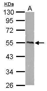 CaMKI gamma antibody detects CaMKI gamma protein by Western blot analysis. A. 50 μg mouse brain lysate/extract 10 % SDS-PAGE CaMKI gamma antibody (GTX105879) dilution: 1:5000