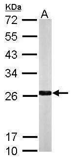 Sample (50 μg of whole cell lysate) A: Mouse liver 12% SDS PAGE GTX105899 diluted at 1:1000 The HRP-conjugated anti-rabbit IgG antibody (GTX213110-01) was used to detect the primary antibody.