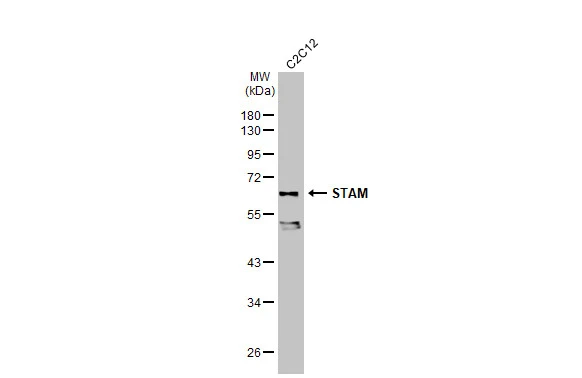 Whole cell extract (30 μg) was separated by 10% SDS-PAGE, and the membrane was blotted with STAM antibody (GTX105927) diluted at 1:10000. The HRP-conjugated anti-rabbit IgG antibody (GTX213110-01) was used to detect the primary antibody.