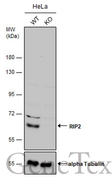 Wild-type (WT) and RIP2 knockout (KO) HeLa cell extracts (30 μg) were separated by 7.5% SDS-PAGE, and the membrane was blotted with RIP2 antibody [N3C3] (GTX105939) diluted at 1:500. The HRP-conjugated anti-rabbit IgG antibody (GTX213110-01) was used to detect the primary antibody.