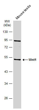 Mouse tissue extract (50 μg) was separated by 10% SDS-PAGE, and the membrane was blotted with Wnt1 antibody (GTX105955) diluted at 1:500. The HRP-conjugated anti-rabbit IgG antibody (GTX213110-01) was used to detect the primary antibody, and the signal was developed with Trident ECL plus-Enhanced.