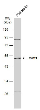 Rat tissue extract (50 μg) was separated by 10% SDS-PAGE, and the membrane was blotted with Wnt1 antibody (GTX105955) diluted at 1:500. The HRP-conjugated anti-rabbit IgG antibody (GTX213110-01) was used to detect the primary antibody, and the signal was developed with Trident ECL plus-Enhanced.