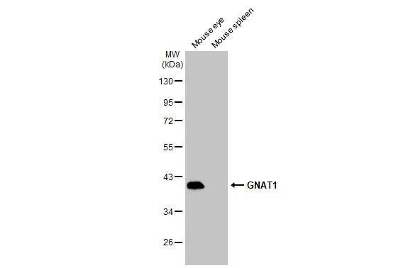 Various tissue extracts (30 μg) were separated by 10% SDS-PAGE, and the membrane was blotted with GNAT1 antibody [N1C3] (GTX105960) diluted at 1:3000. The HRP-conjugated anti-rabbit IgG antibody (GTX213110-01) was used to detect the primary antibody.
