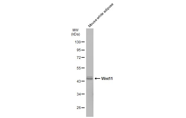 Mouse tissue extract (50 μg) was separated by 10% SDS-PAGE, and the membrane was blotted with Wnt11 antibody (GTX105971) diluted at 1:1000. The HRP-conjugated anti-rabbit IgG antibody (GTX213110-01) was used to detect the primary antibody.