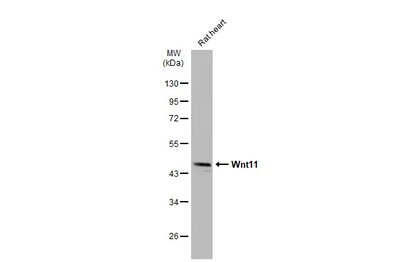 Rat tissue extract (50 μg) was separated by 10% SDS-PAGE, and the membrane was blotted with Wnt11 antibody (GTX105971) diluted at 1:5000. The HRP-conjugated anti-rabbit IgG antibody (GTX213110-01) was used to detect the primary antibody, and the signal was developed with Trident ECL plus-Enhanced.