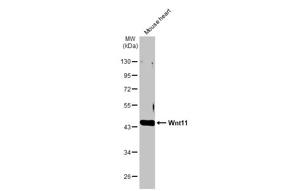 Mouse tissue extract (50 μg) was separated by 10% SDS-PAGE, and the membrane was blotted with Wnt11 antibody (GTX105971) diluted at 1:1000. The HRP-conjugated anti-rabbit IgG antibody (GTX213110-01) was used to detect the primary antibody.