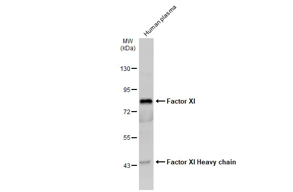 Anti-Factor XI antibody [N1N3] (GTX105974) | GeneTex