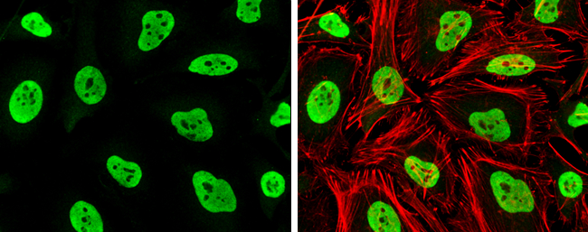 Anti-Rad21 antibody (GTX106012) | GeneTex Anti-Rad21 antibody (GTX106012) | GeneTex