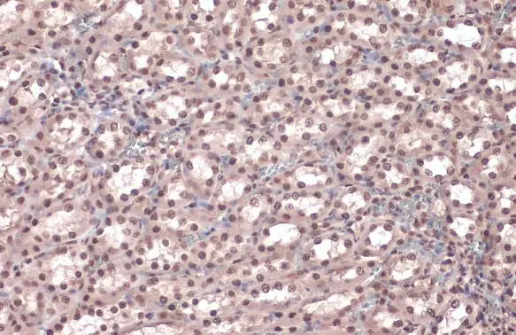 Anti-Rad21 antibody (GTX106012) | GeneTex Anti-Rad21 antibody (GTX106012) | GeneTex