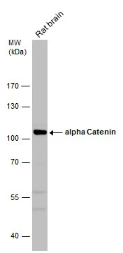 Rat tissue extract (50 μg) was separated by 7.5% SDS-PAGE, and the membrane was blotted with alpha Catenin antibody (GTX106014) diluted at 1:500.