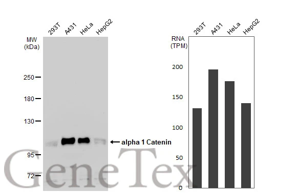 Various whole cell extracts (30 μg) were separated by 5% SDS-PAGE, and the membrane was blotted with alpha 1 Catenin antibody (GTX106014) diluted at 1:1000. The HRP-conjugated anti-rabbit IgG antibody (GTX213110-01) was used to detect the primary antibody. Corresponding RNA expression data for the same cell lines are based on Human Protein Atlas program.