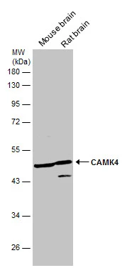Various tissue extracts (50 μg) were separated by 10% SDS-PAGE, and the membrane was blotted with CAMK4 antibody [N1C3] (GTX106023) diluted at 1:500.