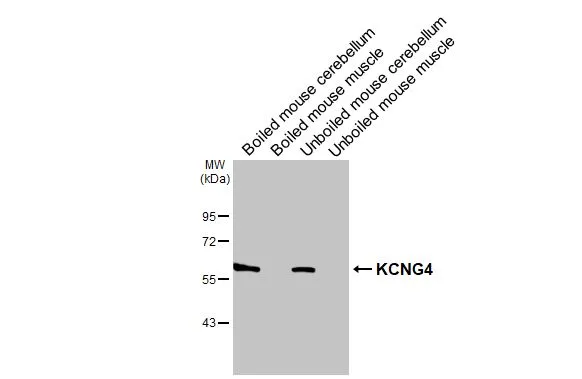 Boiled and unboiled various tissue extracts (50 μg) were separated by 10% SDS-PAGE, and the membrane was blotted with KCNG4 antibody (GTX106058) diluted at 1:1000. The HRP-conjugated anti-rabbit IgG antibody (GTX213110-01) was used to detect the primary antibody. Boiled and unboiled various tissue extracts (50 μg) were separated by 10% SDS-PAGE, and the membrane was blotted with KCNG4 antibody (GTX106058) diluted at 1:1000. The HRP-conjugated anti-rabbit IgG antibody (GTX213110-01) was used to detect the primary antibody.