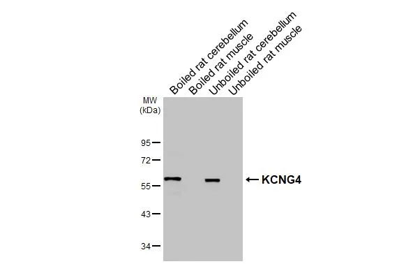 Boiled and unboiled various tissue extracts (50 μg) were separated by 10% SDS-PAGE, and the membrane was blotted with KCNG4 antibody (GTX106058) diluted at 1:1000. The HRP-conjugated anti-rabbit IgG antibody (GTX213110-01) was used to detect the primary antibody. Boiled and unboiled various tissue extracts (50 μg) were separated by 10% SDS-PAGE, and the membrane was blotted with KCNG4 antibody (GTX106058) diluted at 1:1000. The HRP-conjugated anti-rabbit IgG antibody (GTX213110-01) was used to detect the primary antibody.