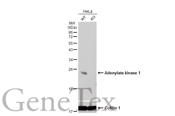 Wild-type (WT) and Adenylate kinase 1 knockout (KO) HeLa cell extracts (30 μg) were separated by 12% SDS-PAGE, and the membrane was blotted with Adenylate kinase 1 antibody [N1C3] (GTX106079) diluted at 1:500. The HRP-conjugated anti-rabbit IgG antibody (GTX213110-01) was used to detect the primary antibody.