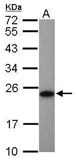 Sample (50 ug of whole cell lysate) A: Mouse brown adipose tissue 12% SDS PAGE GTX106079 diluted at 1:1000