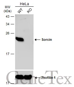 Wild-type (WT) and Sorcin knockout (KO) HeLa cell extracts (30 μg) were separated by 12% SDS-PAGE, and the membrane was blotted with Sorcin antibody [N1C3] (GTX106105) diluted at 1:500. The HRP-conjugated anti-rabbit IgG antibody (GTX213110-01) was used to detect the primary antibody.