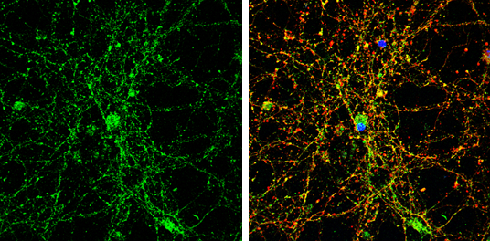 Glycine Receptor alpha 1 antibody [N1C1] detects Glycine Receptor alpha 1 protein by immunofluorescent analysis. Sample: DIV9 rat E18 primary cortical neuron cells were fixed in 4% paraformaldehyde at RT for 15 min. Green: Glycine Receptor alpha 1 stained by Glycine Receptor alpha 1 antibody [N1C1] (GTX106112) diluted at 1:500. Red: beta Tubulin 3/ Tuj1, stained by beta Tubulin 3/ Tuj1 antibody [GT1338] (GTX631831) diluted at 1:500. Blue: Fluoroshield with DAPI (GTX30920).