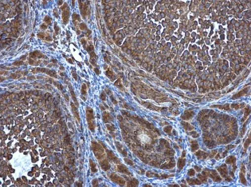 ATG4D antibody [N3C3] detects ATG4D protein at cytoplasm in mouse ovary by immunohistochemical analysis. Sample: Paraffin-embedded mouse ovary. ATG4D antibody [N3C3] (GTX106114) diluted at 1:500. 
 Antigen Retrieval: Citrate buffer, pH 6.0, 15 min