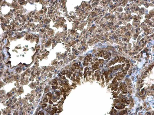 Laminin alpha 4 antibody [C3], C-term detects Laminin alpha 4 protein at cytoplasm on mouse lung by immunohistochemical analysis. Sample: Paraffin-embedded mouse lung. Laminin alpha 4 antibody [C3], C-term (GTX106134) diluted at 1:500. 
 Antigen Retrieval: Trilogy? (EDTA based, pH 8.0) buffer, 15min