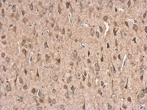 Hsp70 antibody detects Hsp70 protein at cytoplasm in rat brain by immunohistochemical analysis. Sample: Paraffin-embedded rat brain. Hsp70 antibody (GTX106148) diluted at 1:500. Antigen Retrieval: Citrate buffer, pH 6.0, 15 min