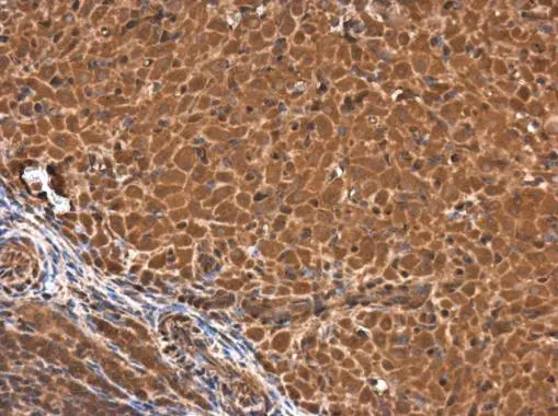 calponin 3 antibody detects calponin 3 protein at cytoplasm in rat ovary by immunohistochemical analysis. Sample: Paraffin-embedded rat ovary. calponin 3 antibody (GTX106174) diluted at 1:500.
Antigen Retrieval: Trilogy? (EDTA based, pH 8.0) buffer, 15min calponin 3 antibody detects calponin 3 protein at cytoplasm in rat ovary by immunohistochemical analysis. Sample: Paraffin-embedded rat ovary. calponin 3 antibody (GTX106174) diluted at 1:500.
Antigen Retrieval: Trilogy? (EDTA based, pH 8.0) buffer, 15min