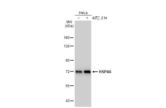 Untreated (–) and treated (+) HeLa whole cell extracts (30 μg) were separated by 7.5% SDS-PAGE, and the membrane was blotted with HSPA6 antibody [C1C3] (GTX106192) diluted at 1:40000. The HRP-conjugated anti-rabbit IgG antibody (GTX213110-01) was used to detect the primary antibody.