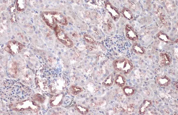 WNK1 antibody detects WNK1 protein at cytoplasm by immunohistochemical analysis. Sample: Paraffin-embedded mouse kidney. WNK1 stained by WNK1 antibody (GTX106197) diluted at 1:500. Antigen Retrieval: Citrate buffer, pH 6.0, 15 min