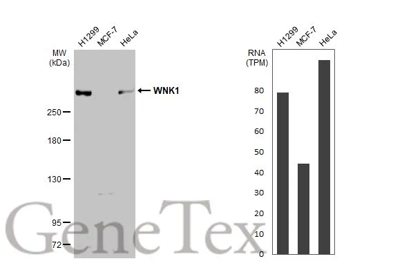 Various whole cell extracts (30 μg) were separated by 5% SDS-PAGE, and the membrane was blotted with WNK1 antibody (GTX106197) diluted at 1:1000. The HRP-conjugated anti-rabbit IgG antibody (GTX213110-01) was used to detect the primary antibody, and the signal was developed with Trident ECL plus-Enhanced. Corresponding RNA expression data for the same cell lines are based on Human Protein Atlas program.