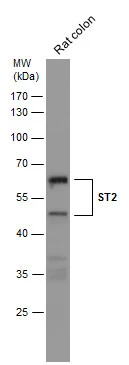 Rat tissue extract (50 μg) was separated by 10% SDS-PAGE, and the membrane was blotted with ST2 antibody [N1C1] (GTX106204) diluted at 1:500.