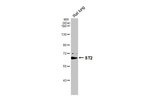 Rat tissue extract (50 μg) was separated by 7.5% SDS-PAGE, and the membrane was blotted with ST2 antibody [N1C1] (GTX106204) diluted at 1:1000. The HRP-conjugated anti-rabbit IgG antibody (GTX213110-01) was used to detect the primary antibody.