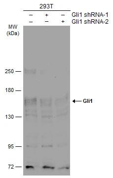 293T whole cell extracts (30 μg) were separated by 5% SDS-PAGE, and the membrane was blotted with Gli1 antibody (GTX106207) diluted at 1:500. The HRP-conjugated anti-rabbit IgG antibody (GTX213110-01) was used to detect the primary antibody.