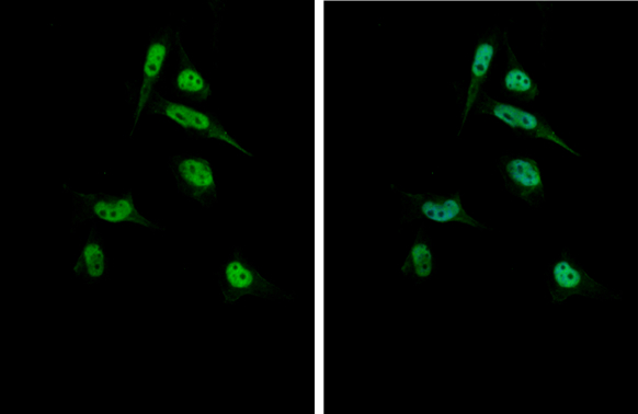 Gli1 antibody detects Gli1 protein at nucleus by immunofluorescent analysis. Sample: RMS-13 cells were fixed in 4% paraformaldehyde at RT for 15 min. Green: Gli1 stained by Gli1 antibody (GTX106207) diluted at 1:500.