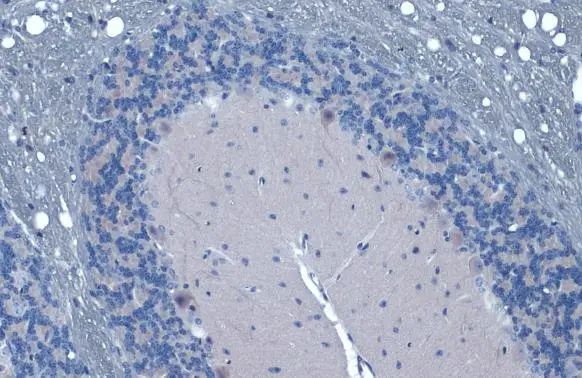 Gli1 antibody detects Gli1 protein at cytoplasm and nucleus by immunohistochemical analysis. Sample: Paraffin-embedded mouse cerebellum. Gli1 stained by Gli1 antibody (GTX106207) diluted at 1:500. Antigen Retrieval: Citrate buffer, pH 6.0, 15 min