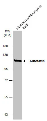 Human Cerebrospinal Fluid (30 μg) was separated by 7.5% SDS-PAGE, and the membrane was blotted with Autotaxin antibody (GTX106209) diluted at 1:1000. The HRP-conjugated anti-rabbit IgG antibody (GTX213110-01) was used to detect the primary antibody.