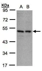 Sample(30 ug whole cell lysate) A:A431(GTX27909) B:H1299 10% SDS PAGE GTX106239 diluted at 1:1000