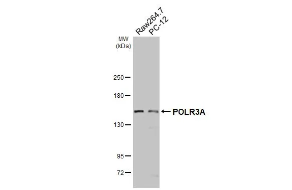 Various whole cell extracts (30 μg) were separated by 5% SDS-PAGE, and the membrane was blotted with POLR3A antibody (GTX106241) diluted at 1:1000. The HRP-conjugated anti-rabbit IgG antibody (GTX213110-01) was used to detect the primary antibody. Various whole cell extracts (30 μg) were separated by 5% SDS-PAGE, and the membrane was blotted with POLR3A antibody (GTX106241) diluted at 1:1000. The HRP-conjugated anti-rabbit IgG antibody (GTX213110-01) was used to detect the primary antibody.