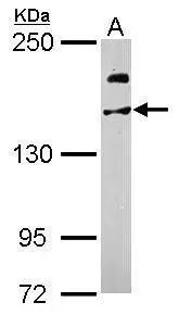 Sample (50 ug of whole cell lysate) A: Mouse brain 5% SDS PAGE GTX106253 diluted at 1:1000
