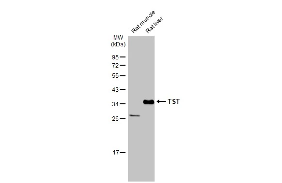 Various tissue extracts (50 μg) were separated by 12% SDS-PAGE, and the membrane was blotted with TST antibody (GTX106257) diluted at 1:3000. The HRP-conjugated anti-rabbit IgG antibody (GTX213110-01) was used to detect the primary antibody.