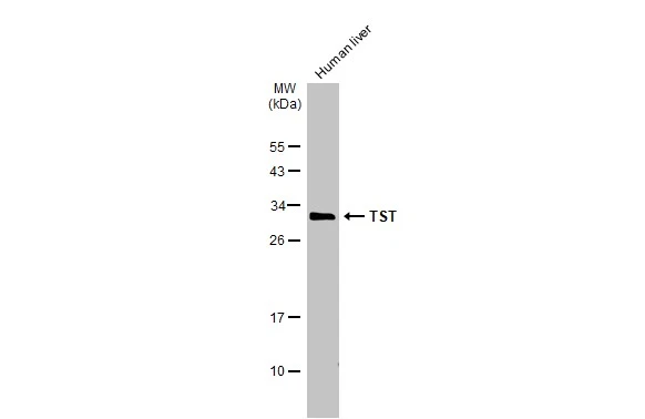 Human tissue extract (50 μg) was separated by 12% SDS-PAGE, and the membrane was blotted with TST antibody (GTX106257) diluted at 1:3000. The HRP-conjugated anti-rabbit IgG antibody (GTX213110-01) was used to detect the primary antibody.